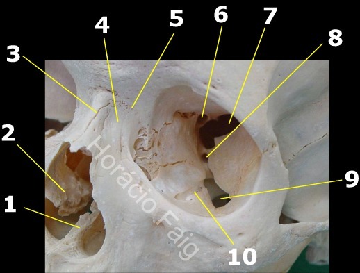 Osso do Quadril - Anatomia Quiz