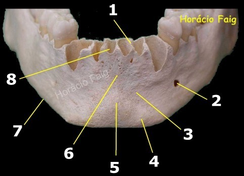 acidente maxilar e mandibula